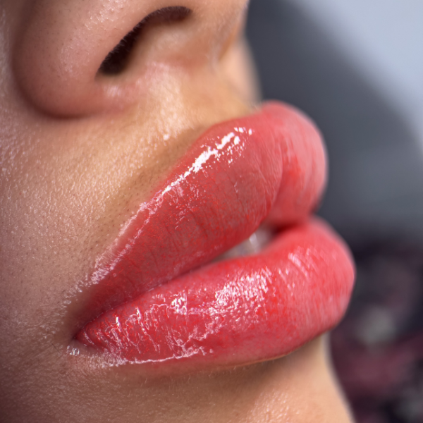 labios